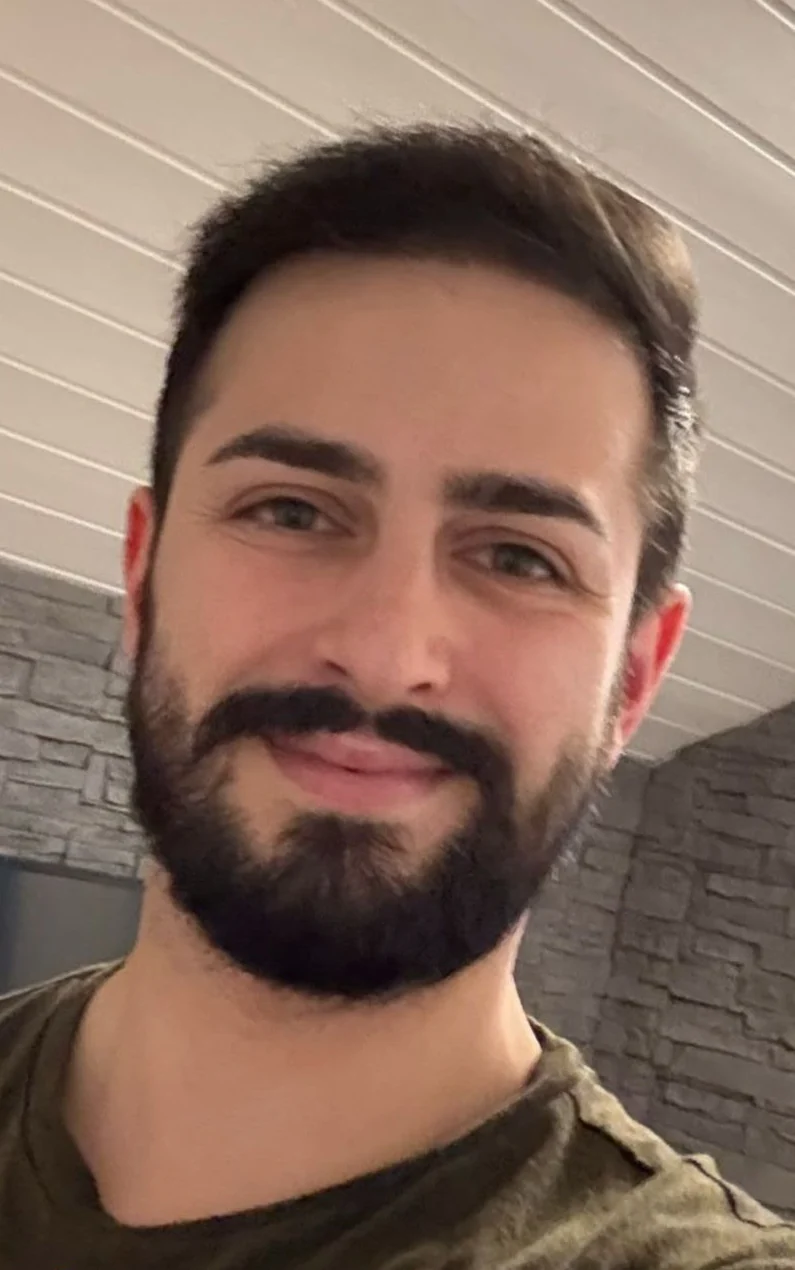 Risultato dopo il trapianto di capelli