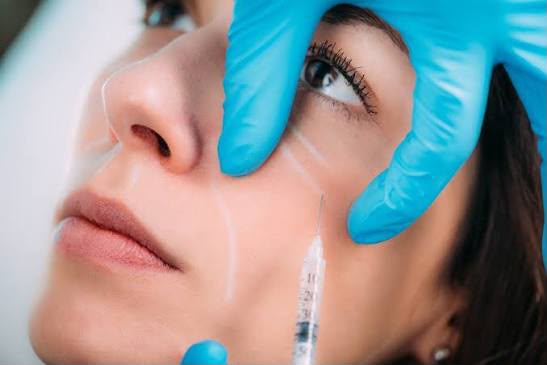 Trattamento mediante iniezione di collagene in EsteCenter Istanbul