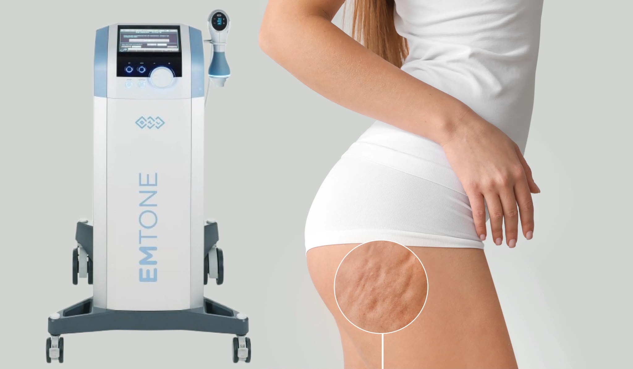 Trattamento cellulite Emtone presso EsteCenter Istanbul