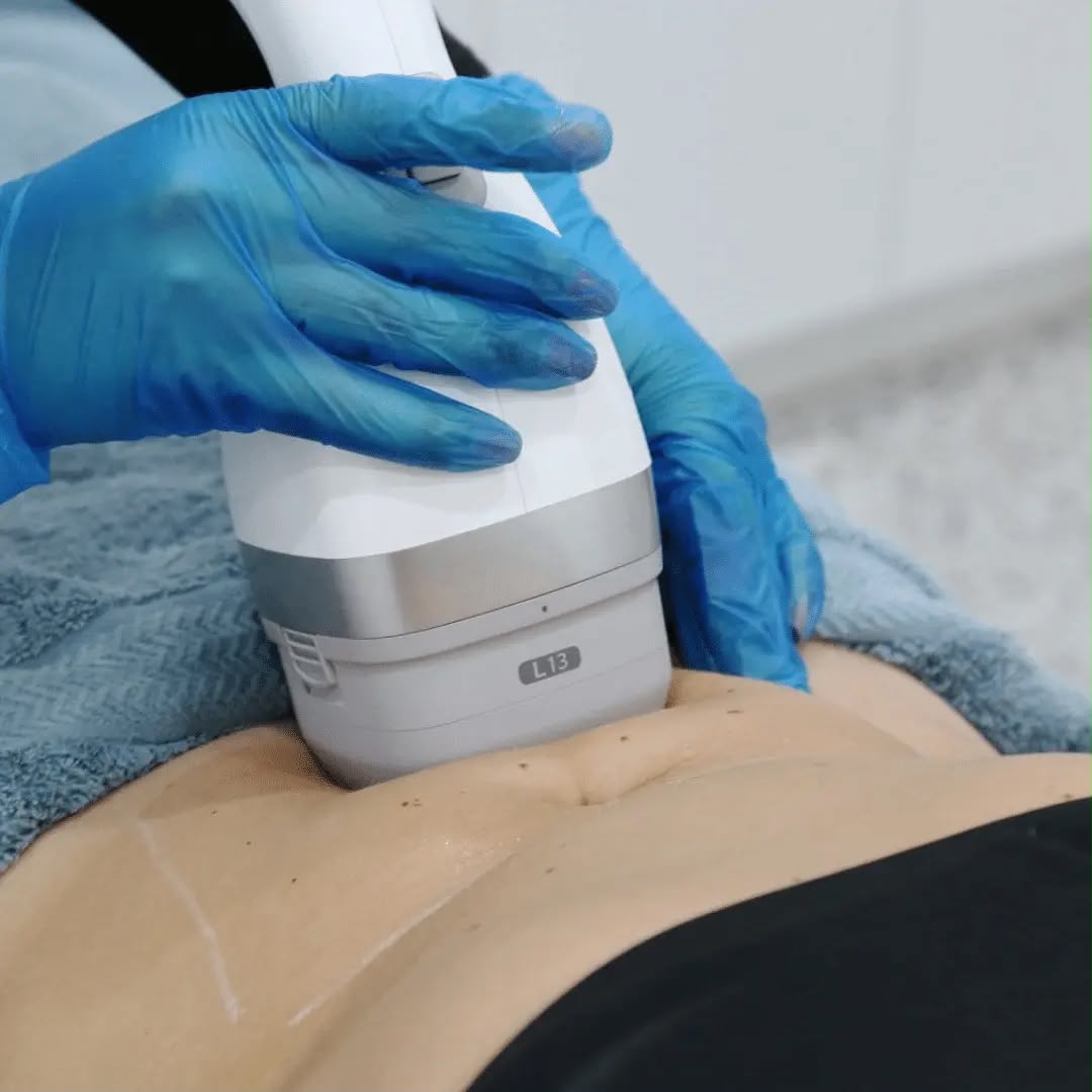 Lipocel Cool Sonic Riduzione del grasso ad ultrasuoni presso EsteCenter Istanbul