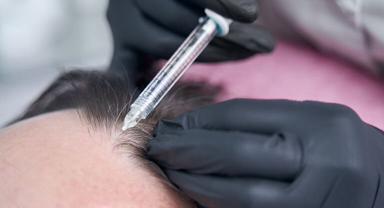 Iniezioni di mesoterapia rivitalizzante in EsteCenter Istanbul