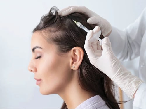 Terapia con plasma ricco di piastrine PRP in EsteCenter Istanbul