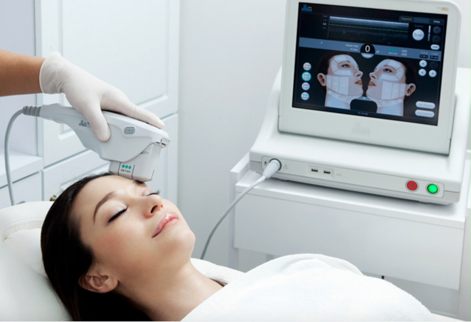Lifting cutaneo ad ultrasuoni Ultherapy presso EsteCenter Istanbul